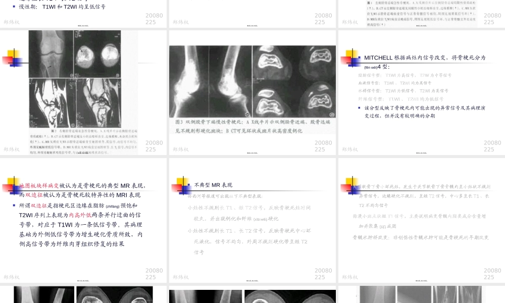 2022年医学专题—浅论骨梗死080225(1).ppt
