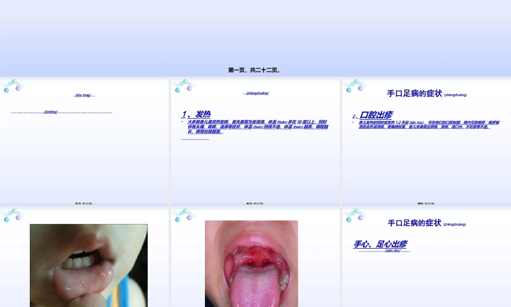 2022年医学专题—浅谈手足口病(1).ppt