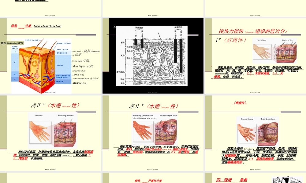 2022年医学专题—烧伤严重程度评估(1).ppt