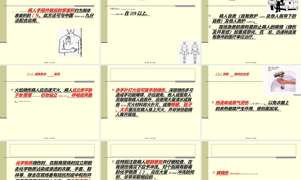 2022年医学专题—烧伤严重程度评估(1).ppt