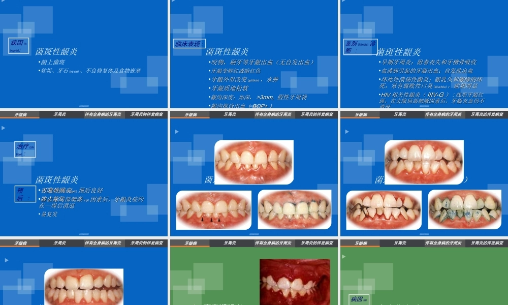 2022年医学专题—牙周病分类及龈炎各论(1).ppt