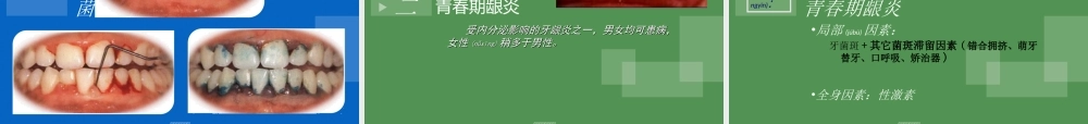 2022年医学专题—牙周病分类及龈炎各论(1).ppt