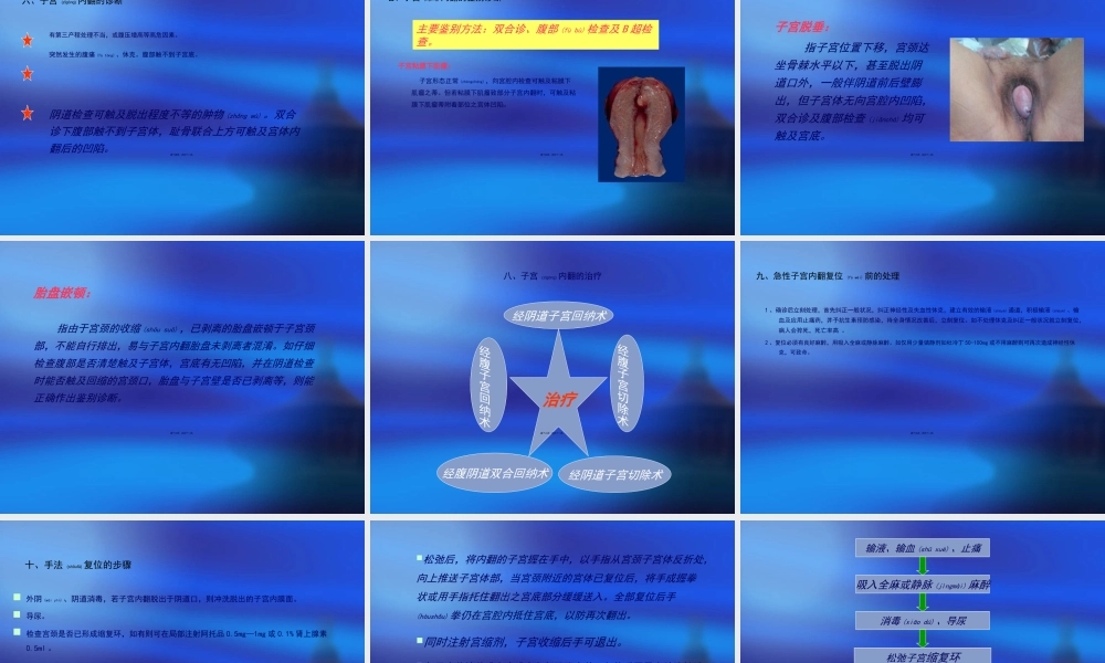 2022年医学专题—特殊产后出血3(1).ppt