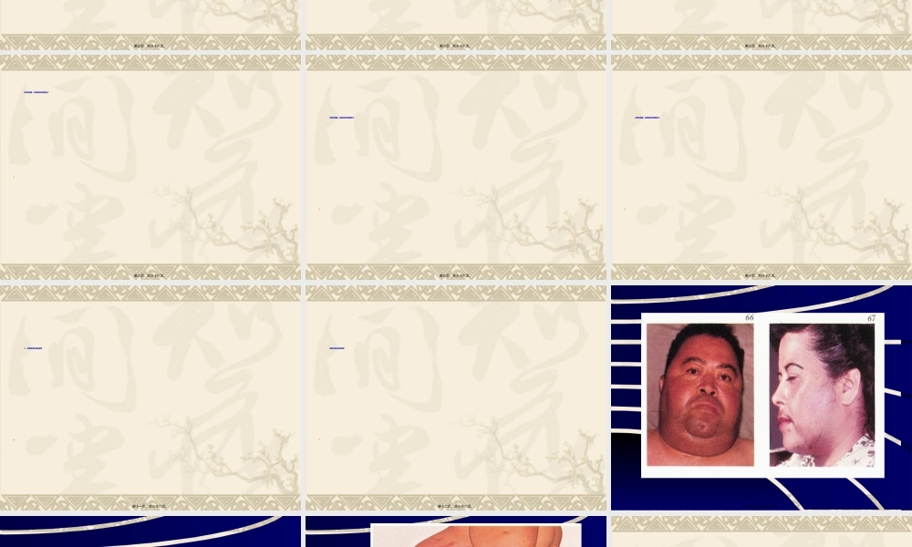 2022年医学专题—皮-质-醇-增-多-症(1).ppt