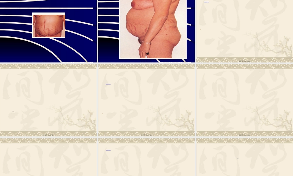 2022年医学专题—皮-质-醇-增-多-症(1).ppt