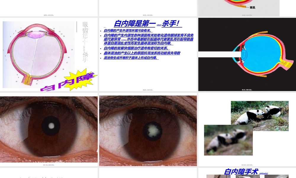 2022年医学专题—眼病(1).ppt