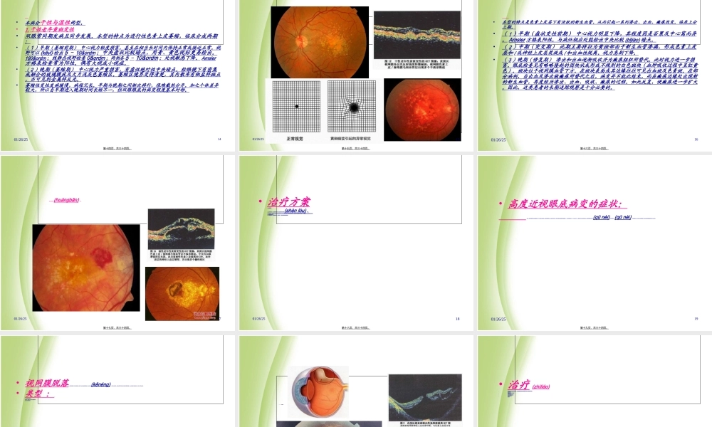 2022年医学专题—眼底病部分(1).ppt