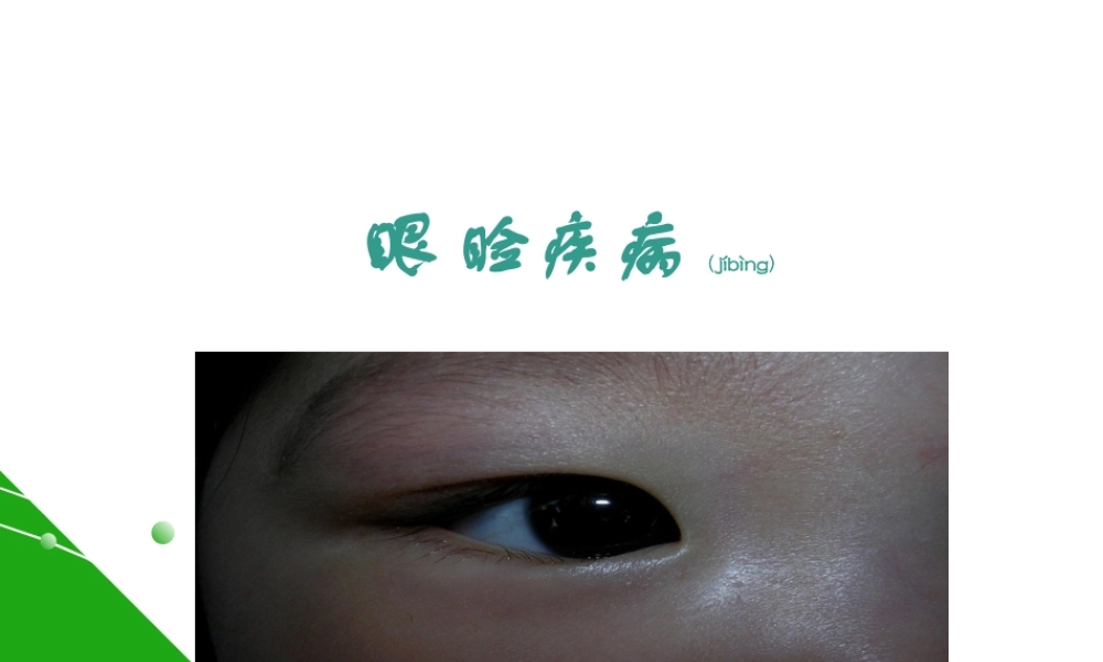 2022年医学专题—眼睑病(1).ppt