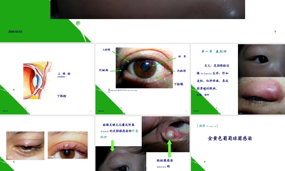 2022年医学专题—眼睑病(1).ppt