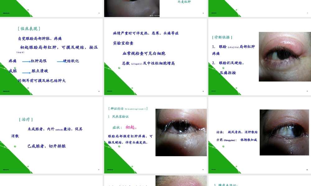 2022年医学专题—眼睑病(1).ppt