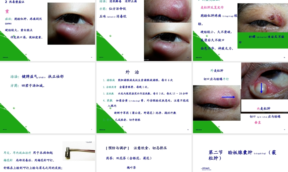2022年医学专题—眼睑病(1).ppt
