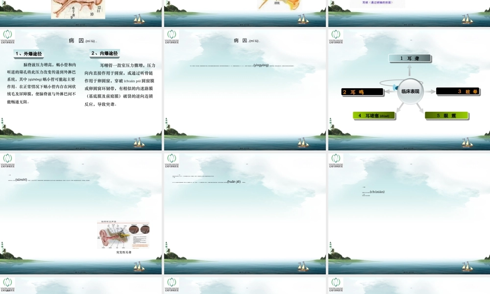 2022年医学专题—突发性耳聋PPT1资料(1).ppt