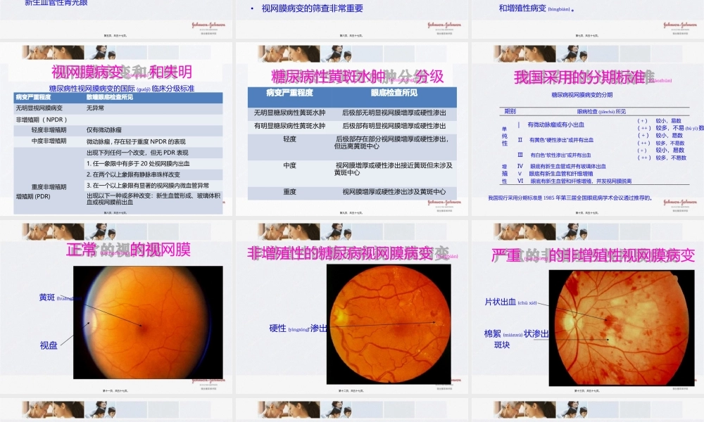 2022年医学专题—糖尿病慢性并发症---微血管病变(1).pptx