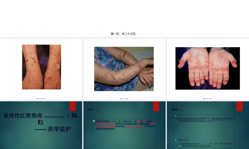 2022年医学专题—系统性红斑狼疮-药学监护(1).ppt