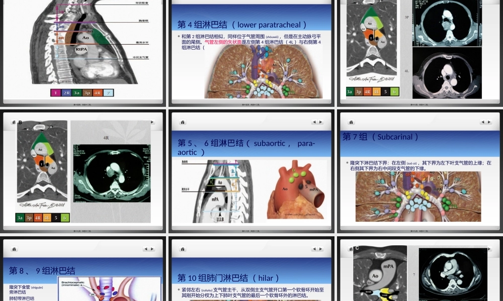 2022年医学专题—纵膈淋巴结节ppt(1).pptx