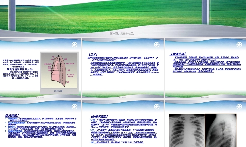 2022年医学专题—纵膈畸胎瘤(1).ppt