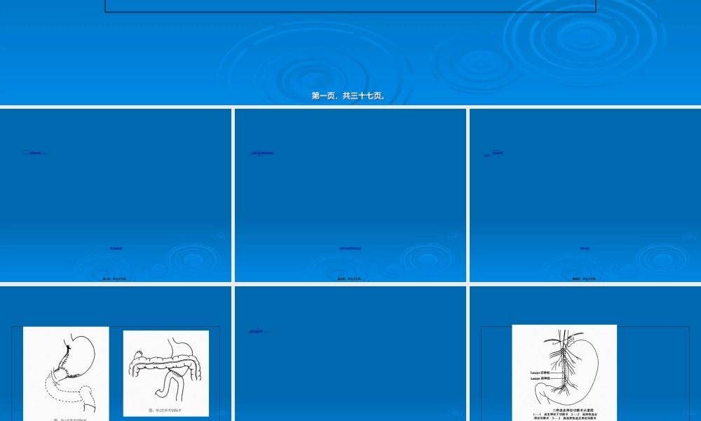 2022年医学专题—胃十二指肠手术的并发症(1).ppt