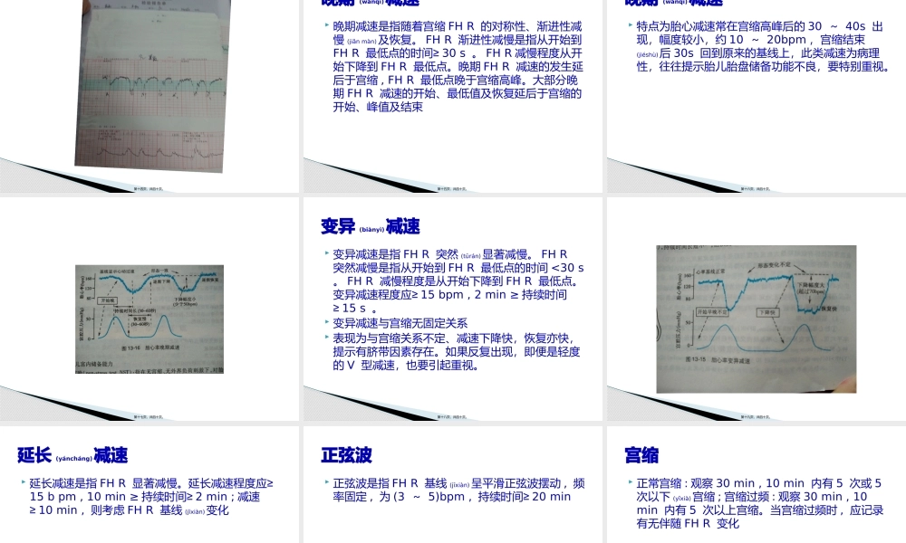 2022年医学专题—胎儿窘迫(1).pptx