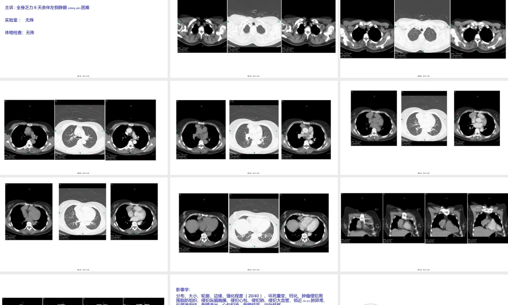 2022年医学专题—胸腺瘤(1).pptx