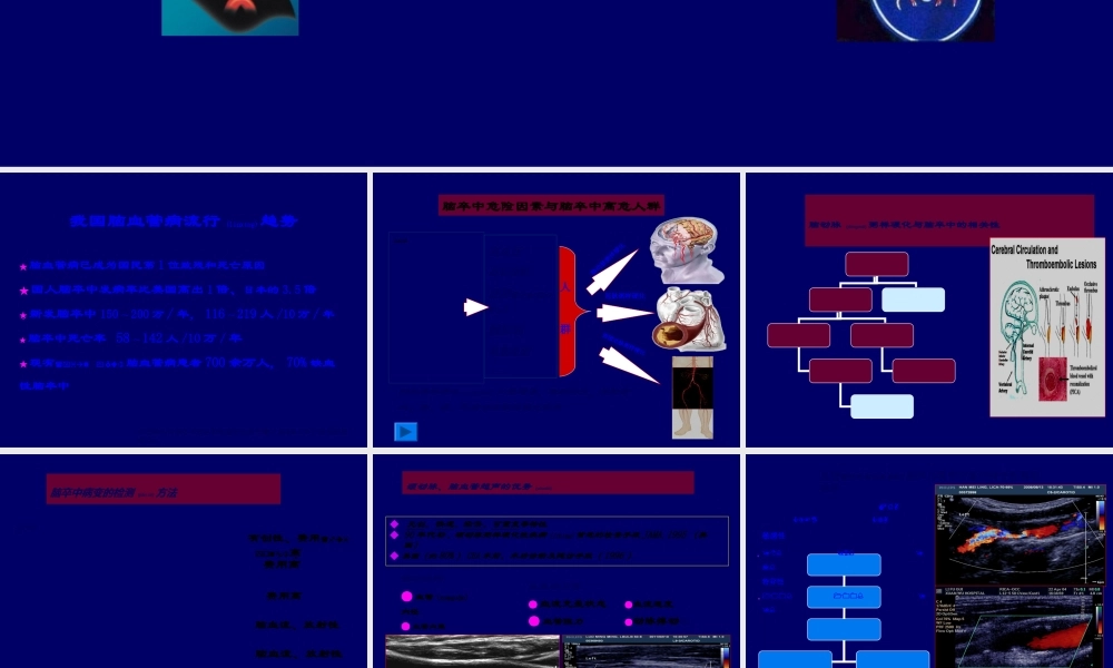 2022年医学专题—脑卒中筛查血管超声检查(1).ppt