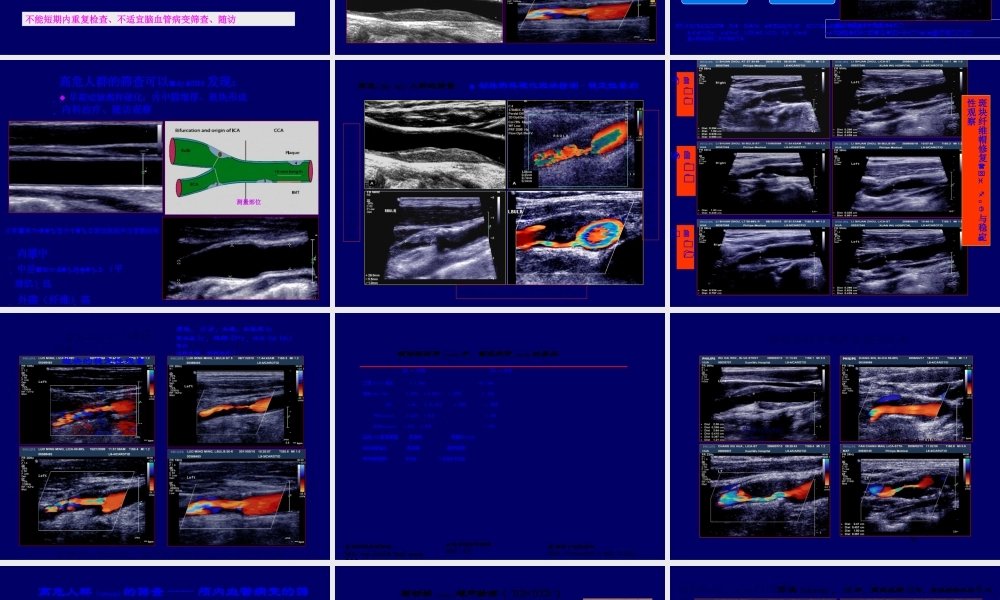 2022年医学专题—脑卒中筛查血管超声检查(1).ppt