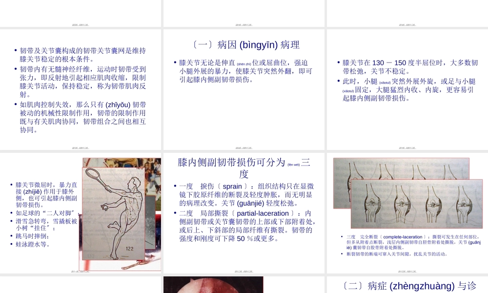 2022年医学专题—膝关节内侧副韧带损伤2(1).ppt
