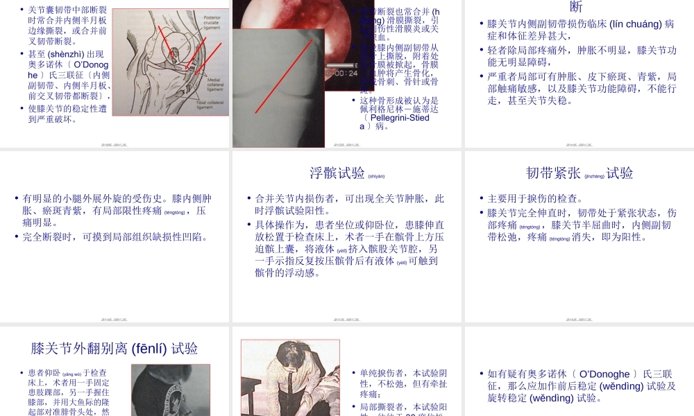 2022年医学专题—膝关节内侧副韧带损伤2(1).ppt