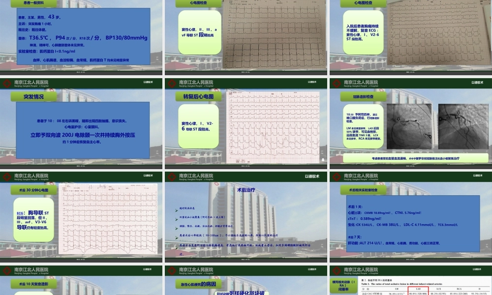 ACS病例讨论(1).ppt
