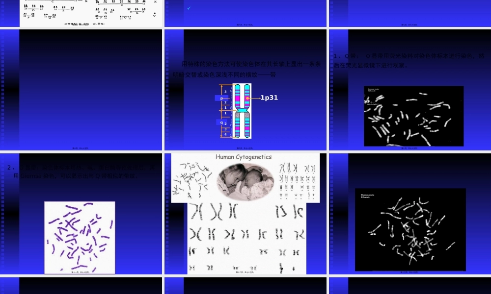 人染色体染色体病(1).pptx
