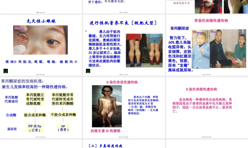 人类遗传病与优生(1).pptx