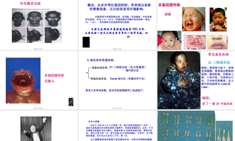 人类遗传病与优生(1).pptx