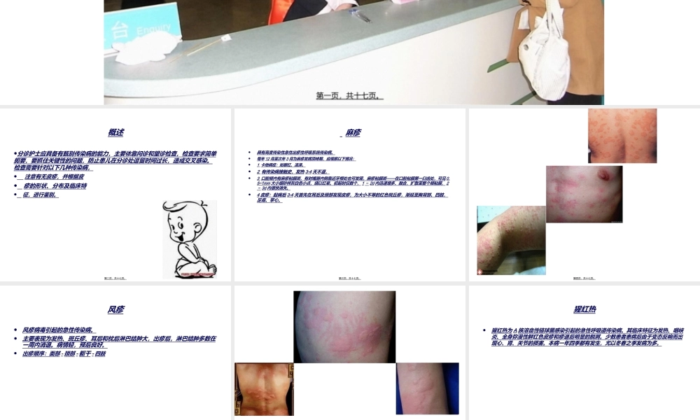 儿科预诊检查方法(1).ppt