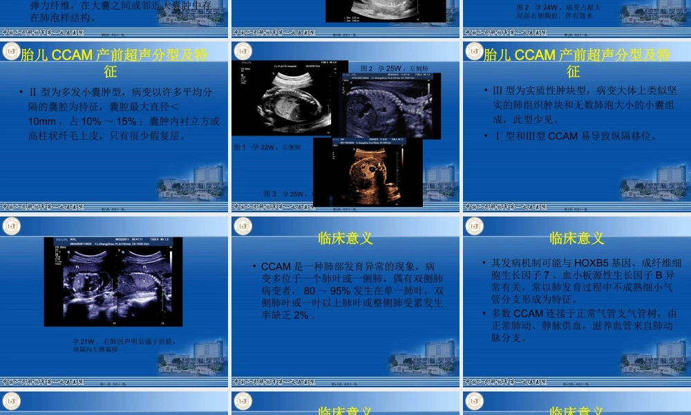 先天性胎儿肺囊腺瘤模板(1).pptx