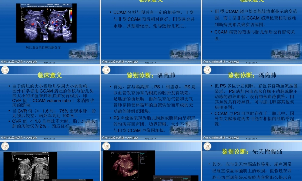 先天性胎儿肺囊腺瘤模板(1).pptx