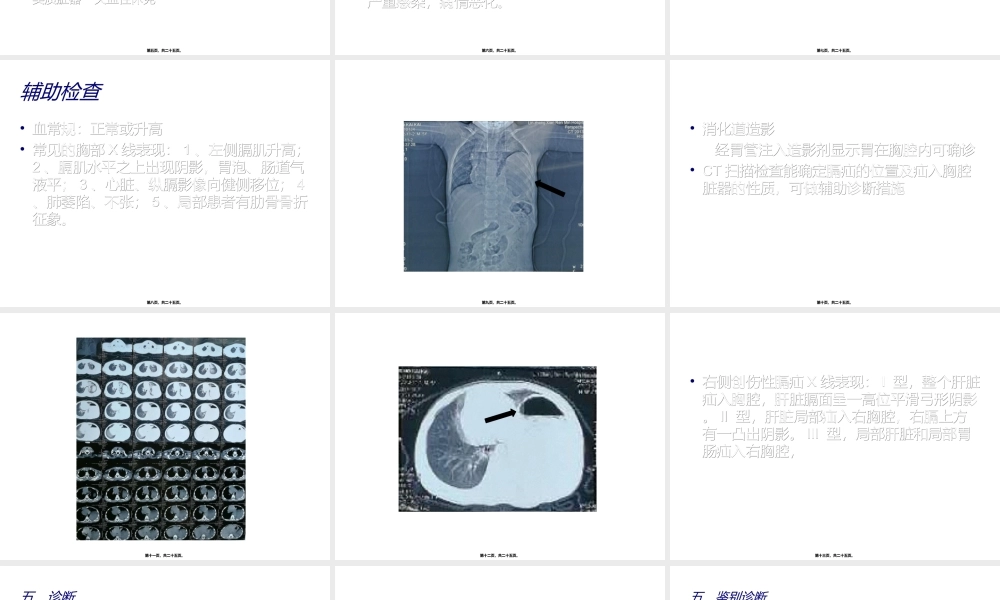 创伤性膈疝(1).ppt