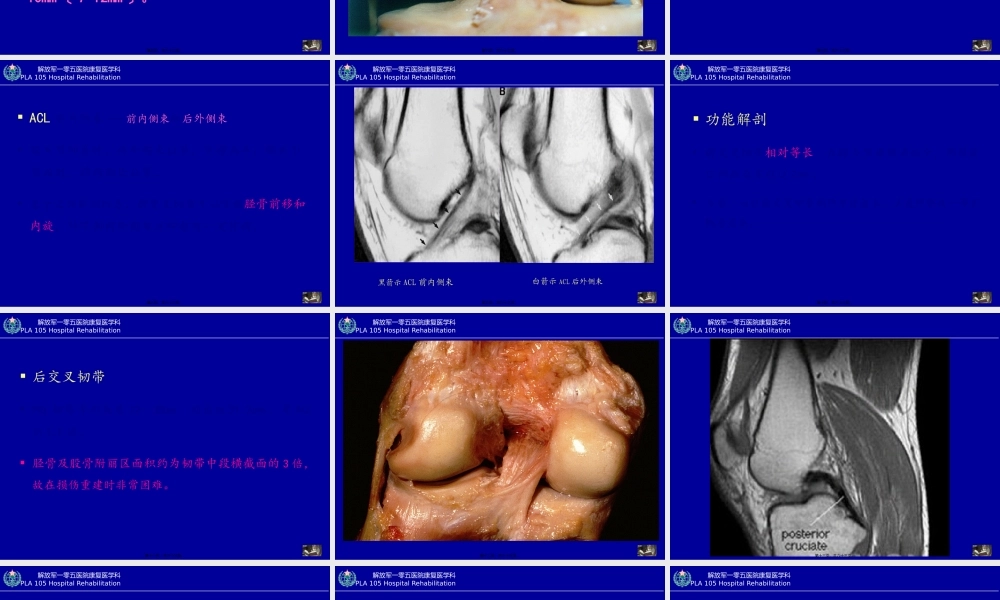 创伤性膝关节功能障碍的康复(1).pptx