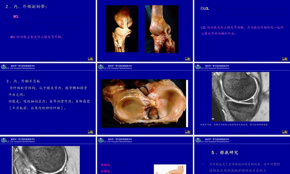 创伤性膝关节功能障碍的康复(1).pptx