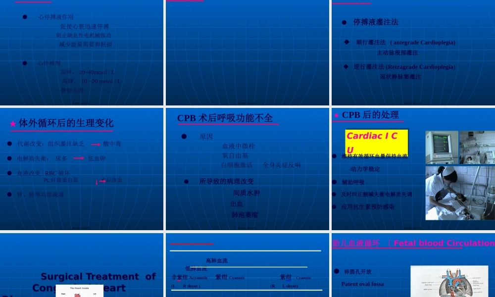 动脉导管开放Patentductusarteriosus动脉导管未闭(1).pptx