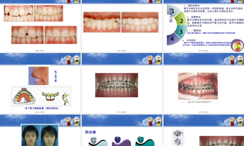 口腔正畸学的概念2(1).pptx