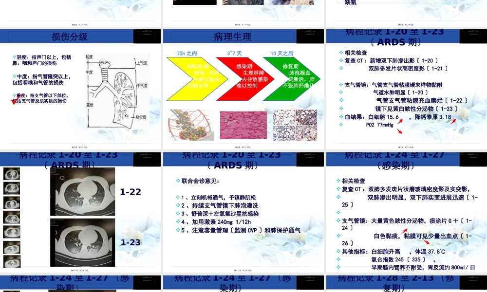 吸入性肺损伤(1).pptx