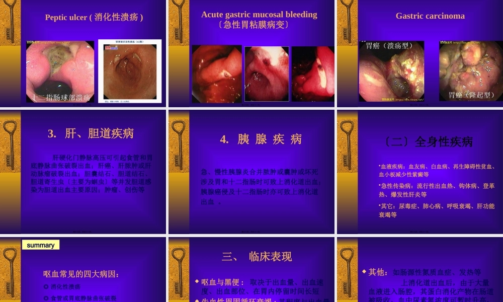 呕血便血2013(1).pptx