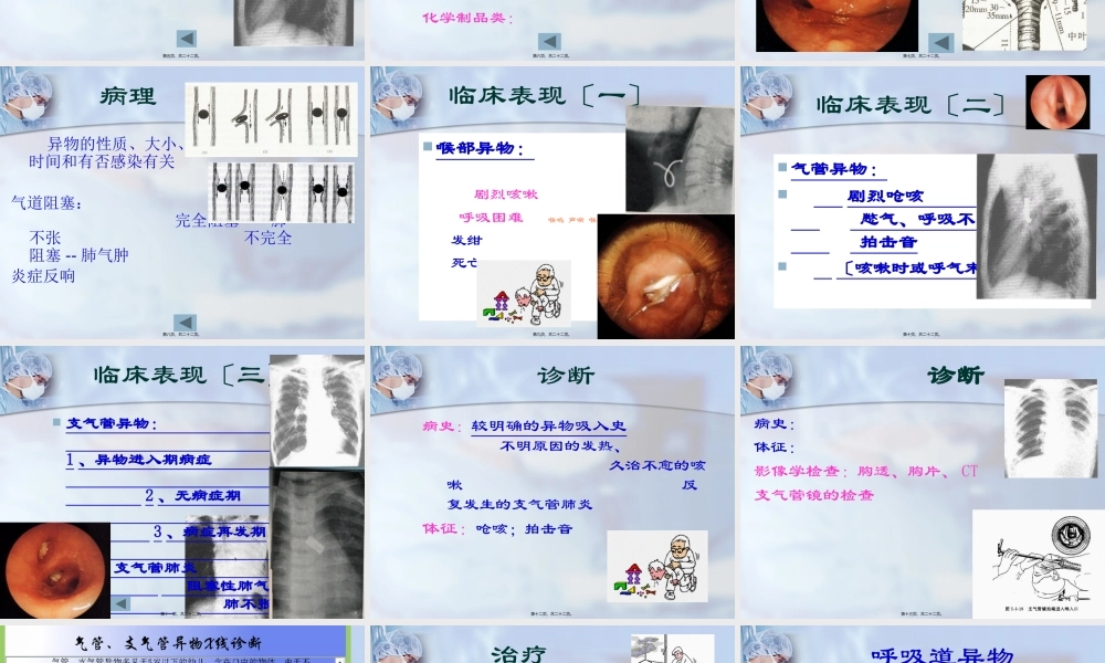 呼吸及消化道异物(1).pptx