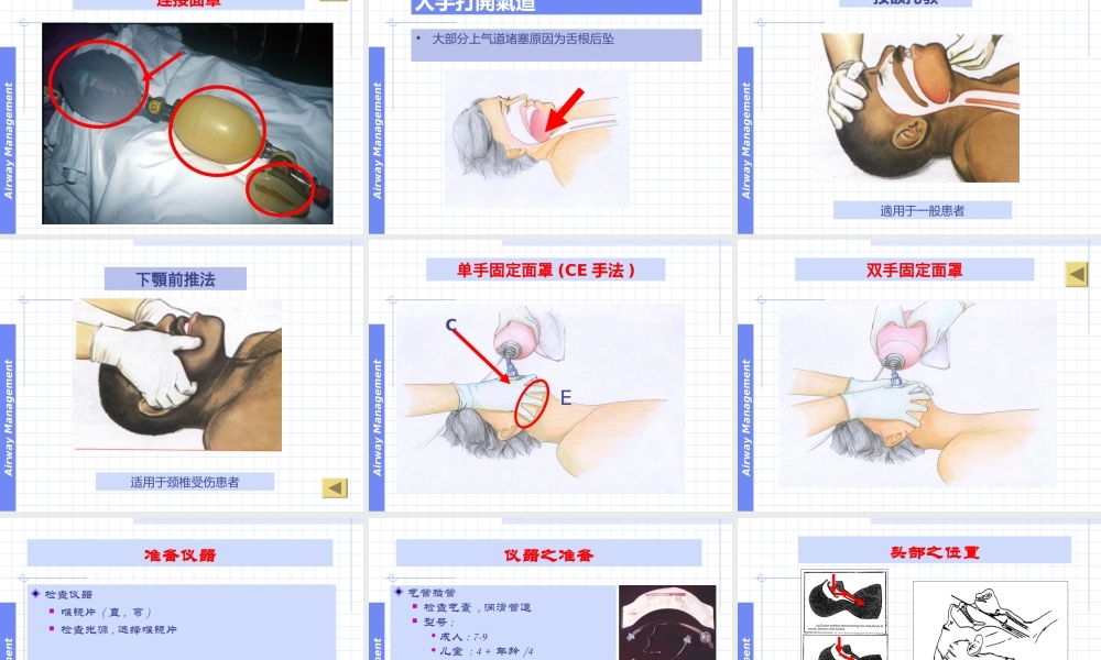 呼吸气囊和气管插管(1).ppt