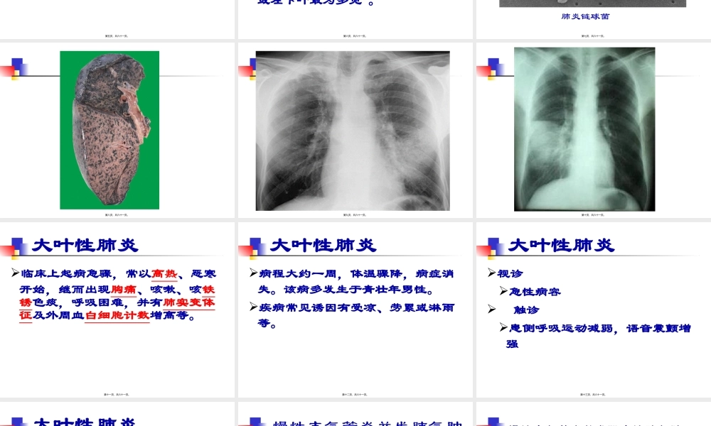 呼吸系统常见病症(1).pptx