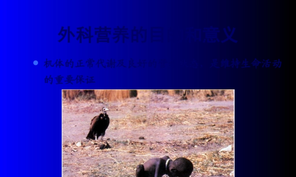 外科病人的营养代谢-秦胜旗(1).pptx