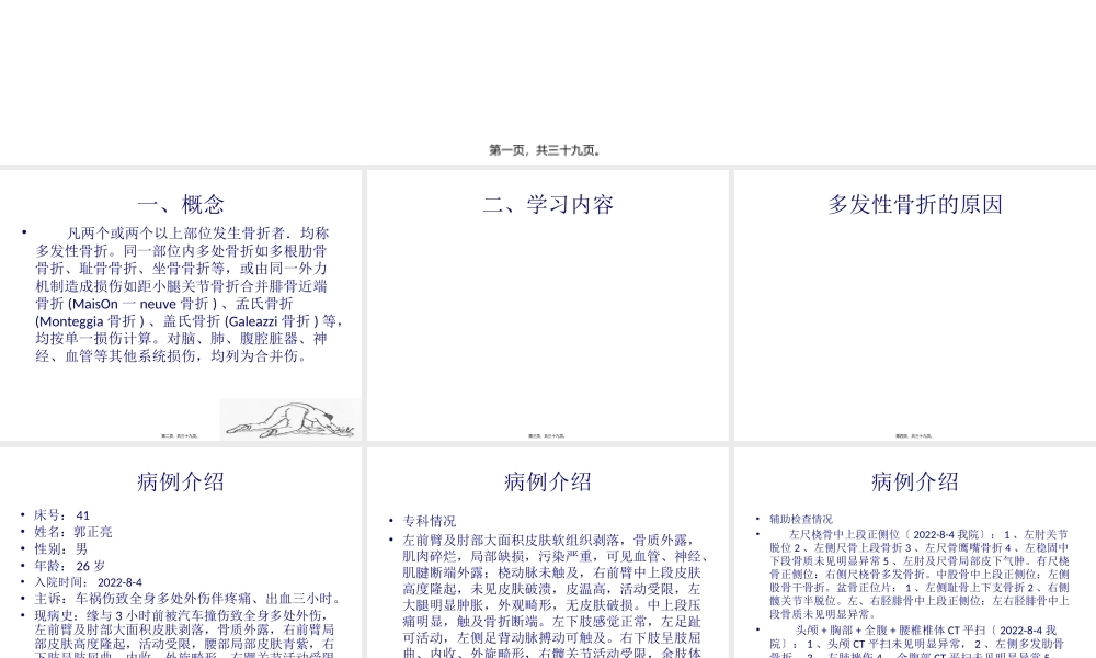 多发性骨折(1).pptx