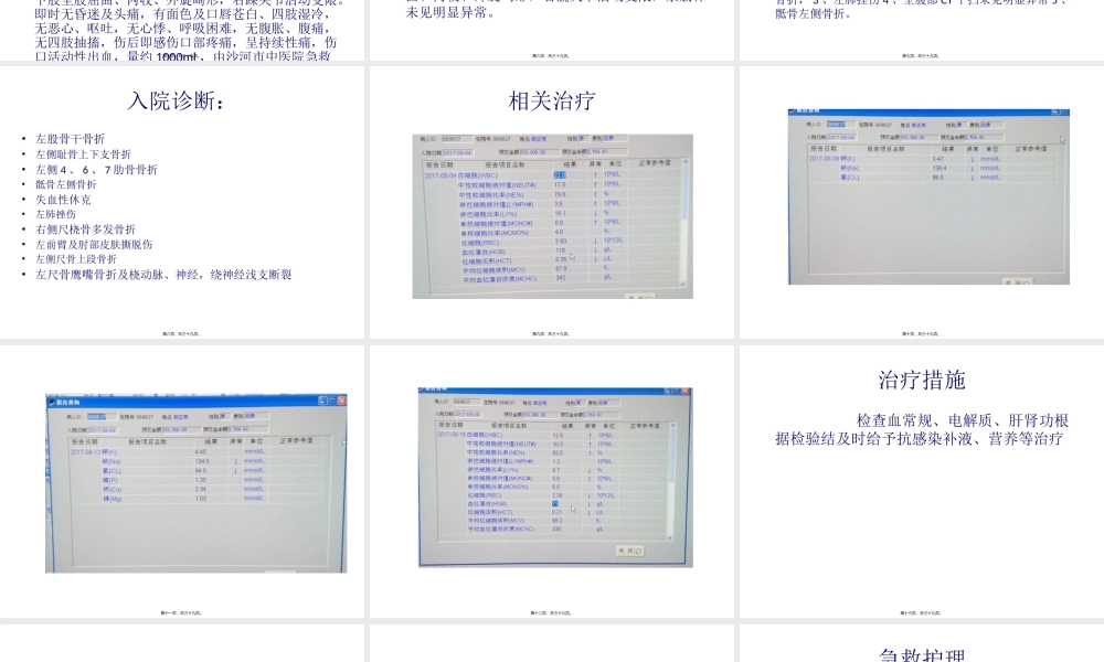 多发性骨折(1).pptx