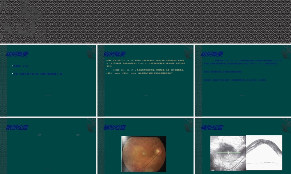 大泡性视网膜脱离疑难病例讨论(1).ppt