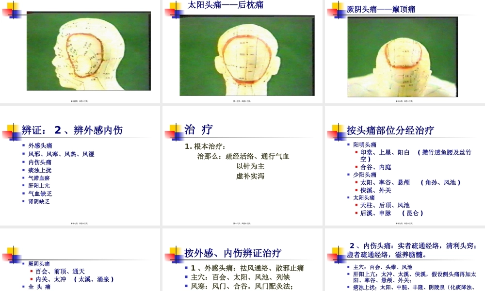 头痛的讲稿(1).pptx