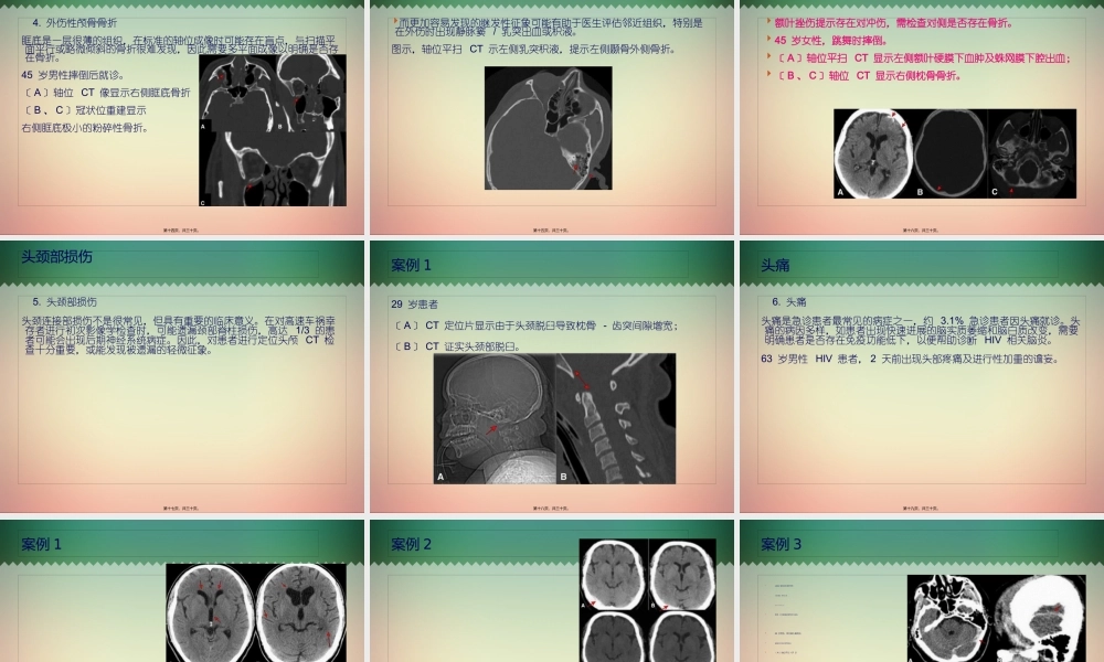 头颅-CT-七大陷阱-你可别中招(1).pptx